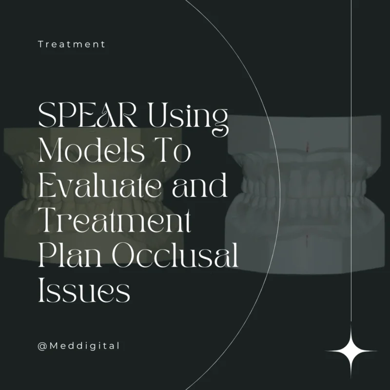 SPEAR Using Models To Evaluate and Treatment Plan Occlusal Issues – Frank Spear